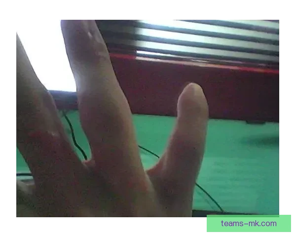 浓眉左手掌恢复良好 本月底将接受复查有望复出